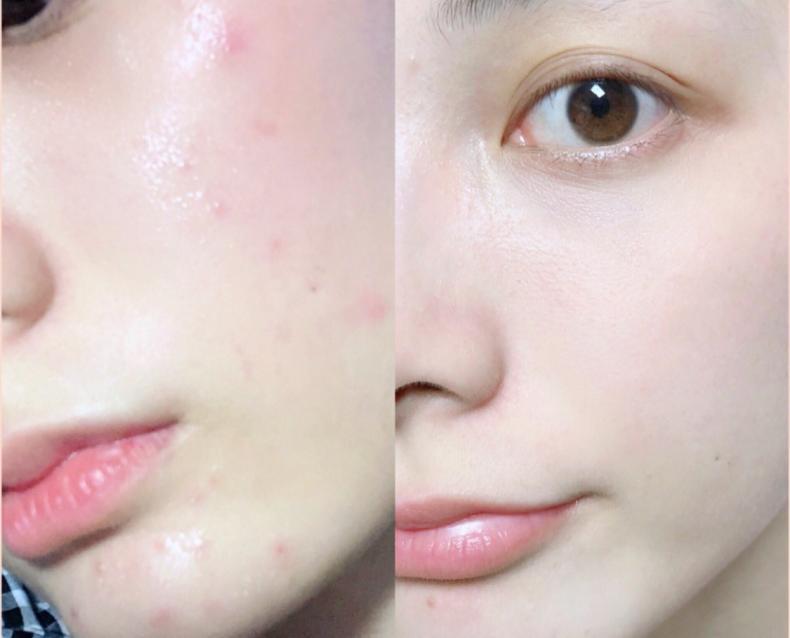 小黑瓶欧莱雅_欧莱雅小黑瓶多少钱_欧莱雅小黑瓶专柜多少钱一瓶